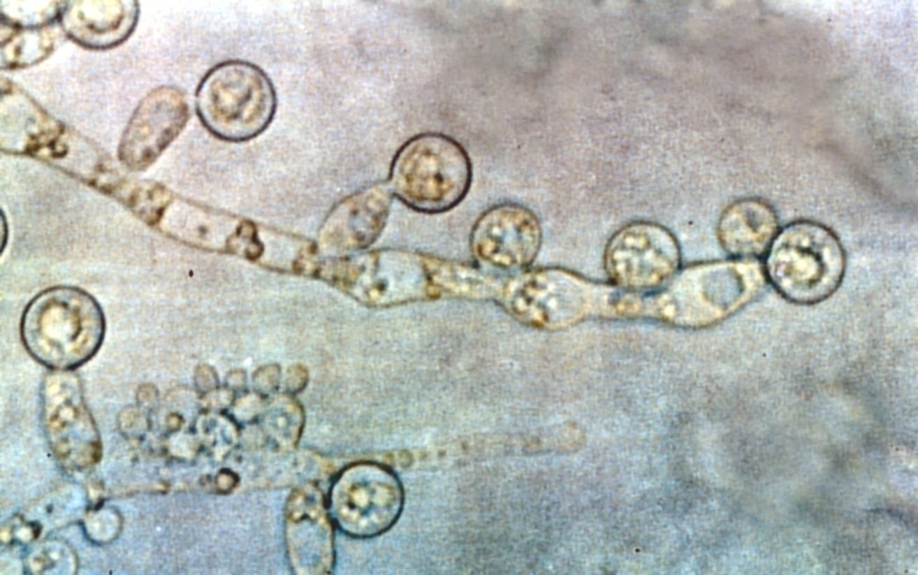 Microscopie opname van Candida albicans (bron Wikipedia)